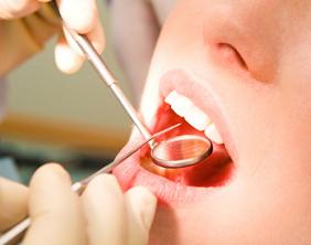 Dental oral exam with mirror instrument in mouth