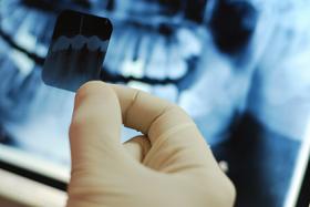 Dental xray images held in hand with xray background