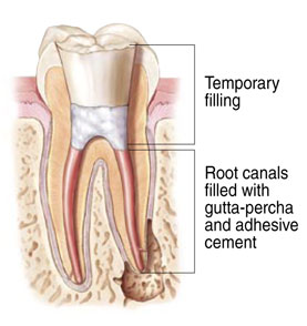 Endodontist patientendo5